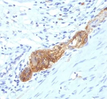 NCAM / CD56 Antibody - image 1