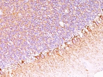Neurofilament Antibody (-Heavy) / NF-H / NEFH - image 1
