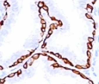 Cytokeratin 14 Antibody / CK14 / KRT14 - image 1