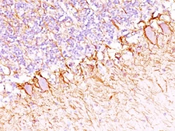 Neurofilament Antibody (-Heavy) / NF-H / NEFH - image 1