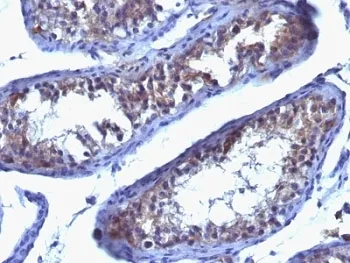 Prolactin Receptor Antibody / PRLR - image 1