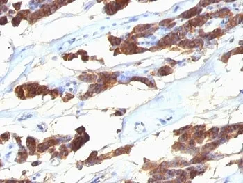 TG Antibody / Thyroglobulin - image 1