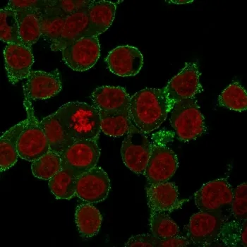 TNF alpha Antibody - image 1