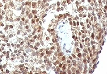 p53 Antibody / TP53 - image 1