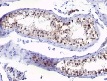Thymidylate Synthase Antibody - image 1