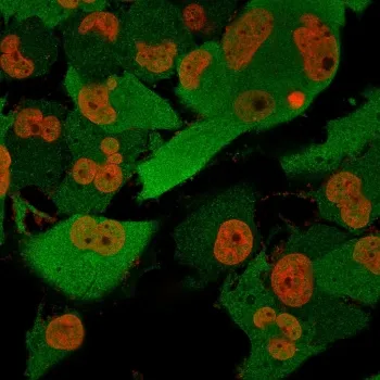 PGP9.5 / UchL1 Antibody - image 1