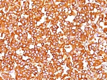 Vimentin Antibody - image 1