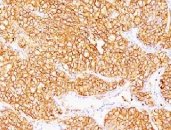 CA9 Antibody / Carbonic Anhydrase IX - image 1