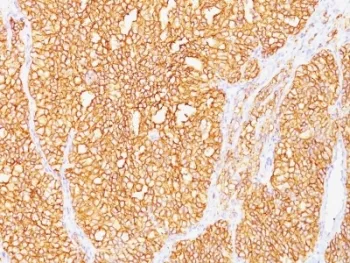 CA9 Antibody / Carbonic Anhydrase IX - image 1