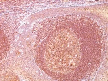 Bcl10 Antibody - image 1
