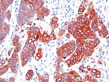 Multi Cytokeratin Antibody - image 1