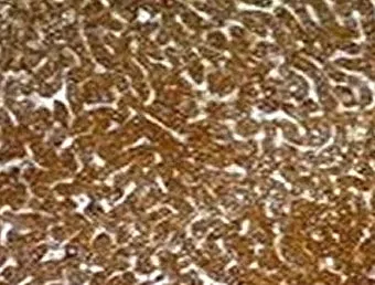 Hepatocyte Specific Antigen Antibody - image 1