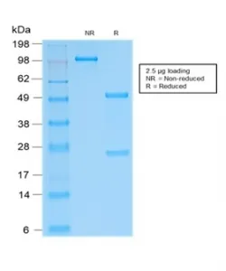SOX9 Recombinant Antibody - image 1