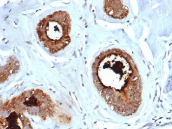 Mammaglobin A Recombinant Antibody / SCGB2A2 - image 1
