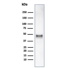 Cyclin E1 Recombinant Antibody / CCNE1 - image 1