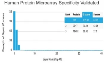 Synaptophysin Recombinant Antibody - image 1