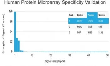 Leptin Receptor Antibody / LEPR - image 1