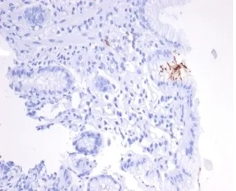 Helicobacter pylori Catalase Antibody - image 1