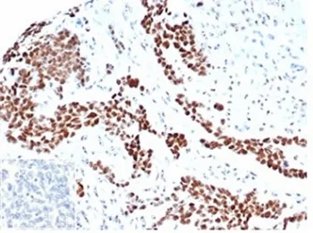 WT1 Recombinant Antibody / Wilms Tumor 1 - image 1