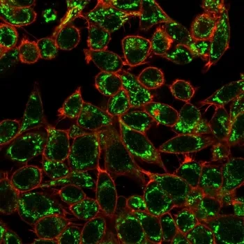 CTBP2 Antibody / C-terminal-binding protein 2 - image 1
