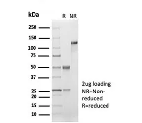 CD33 Recombinant Antibody - image 1