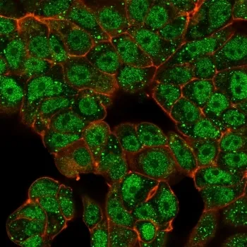 CTBP2 Antibody / C-terminal-binding protein 2 - image 1