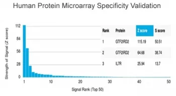 GTF2IRD2 Antibody / GTF2IRD2 alpha - image 1