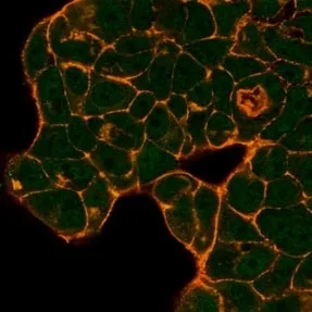PRMT6 Antibody - image 1
