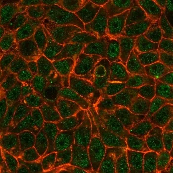 TIF1 alpha Antibody / TIF1A / TRIM24 - image 1