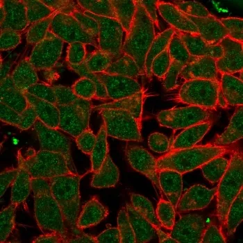 PDX1 Antibody / Pancreas/duodenum homeobox protein 1 - image 1