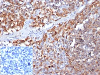 Gamma Parvin Antibody / PARVG - image 1