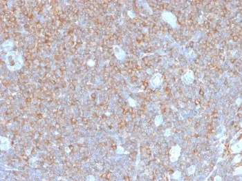 Gamma Parvin Recombinant Antibody / PARVG - image 1