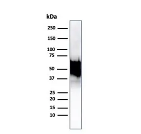 HSP60 Recombinant Antibody - image 1