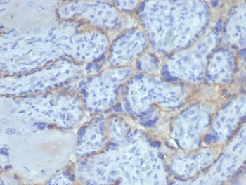 EGF Receptor / EGFR Recombinant Antibody (Extracellular domain) - image 1