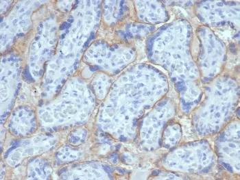 EGF Receptor / EGFR Recombinant Antibody (Extracellular domain) - image 1