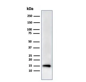 FABP5 Recombinant Antibody - image 1