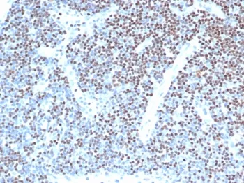 LEF1 Recombinant Antibody / Lymphoid enhancer-binding factor 1 / TCF1 alpha - image 1