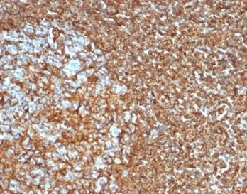 Vimentin Recombinant Antibody - image 1