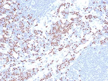 LEF1 Recombinant Antibody / Lymphoid enhancer-binding factor 1 / TCF1 alpha - image 1