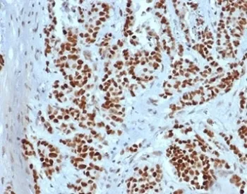 MSH2 Recombinant Antibody - image 1