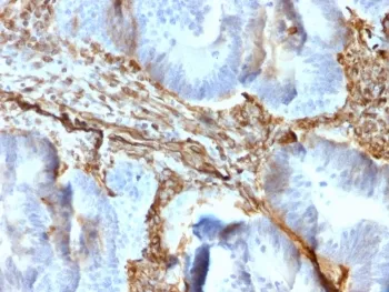 Vimentin Recombinant Antibody - image 1