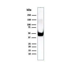 Vimentin Recombinant Antibody - image 1