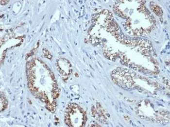 AMACR / p504S Recombinant Antibody (Prostate Cancer Marker) - image 1