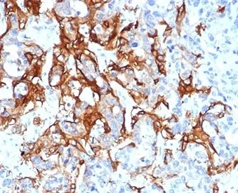 TROP2 Recombinant Antibody / TACSTD2 - image 1