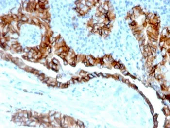TROP2 Recombinant Antibody / TACSTD2 - image 1