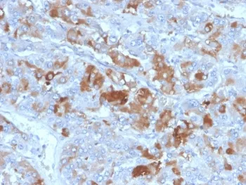 Clusterin Antibody / Apolipoprotein J / APO-J - image 1