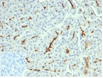 CFTR Recombinant Antibody / Cystic Fibrosis Transmembrane Regulator - image 1