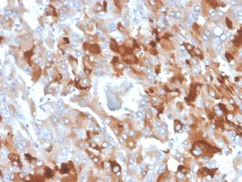 Clusterin Antibody / Apolipoprotein J / APO-J - image 1