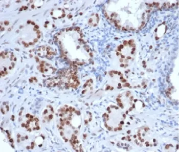 Androgen Receptor Recombinant Antibody - image 1