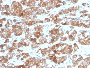 Luteinizing Hormone beta Recombinant Antibody - image 1
